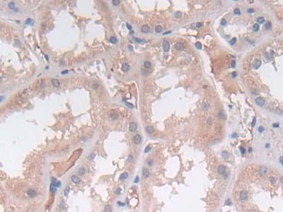 Immunohistochemistry-Paraffin SRY Antibody