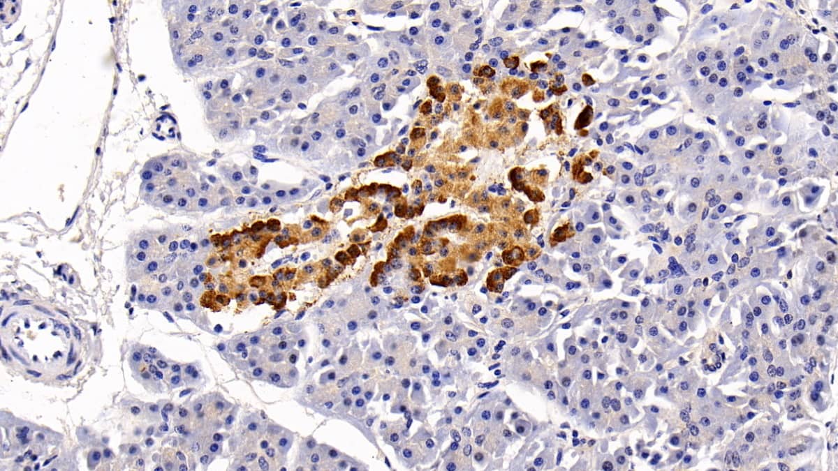 Immunohistochemistry-Paraffin: MTR Antibody [NBP3-41296] - DAB staining on IHC-P; Sample: Human Pancreas Tissue; Primary Ab: 30ug/ml NBP3-41296; Second Ab: 2ug/mL HRP-Linked Caprine Anti-Rabbit IgG Polyclonal Antibody