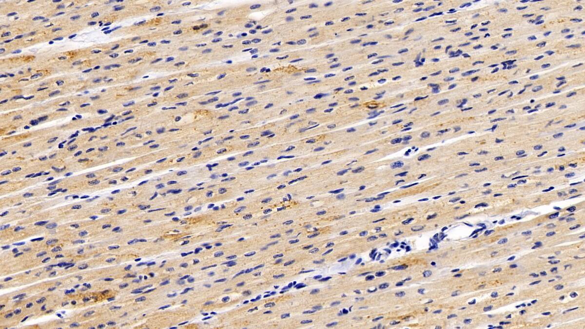 Immunohistochemistry-Paraffin: MTR Antibody [NBP3-41296] - DAB staining on IHC-P; Samples: Human Cardiac Muscle Tissue; Primary Ab: 20ug/ml NBP3-41296; Second Ab: 2ug/mL HRP-Linked Caprine Anti-Rabbit IgG Polyclonal Antibody