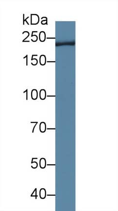 Western Blot Trichohyalin Antibody