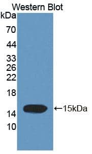 Western Blot: Trichohyalin Antibody [NBP3-41297] - Sample: Recombinant Trichohyalin, Human.