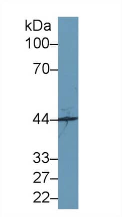 Western Blot SYTL2 Antibody