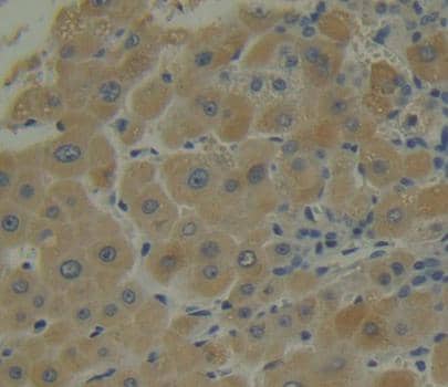 Immunohistochemistry-Paraffin: Snapin Antibody [NBP3-41303] - Used in DAB staining on fromalin fixed paraffin- embedded liver tissue