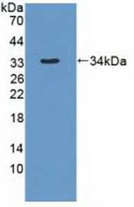 Western Blot: DYNC1H1 Antibody [NBP3-41308] - Sample: Recombinant DYNC1H1, Human.