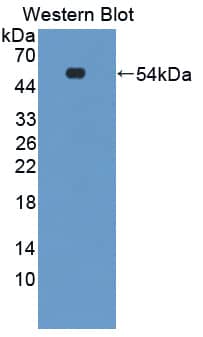 Western Blot: EPB42 Antibody [NBP3-41310] - Sample: Recombinant protein.