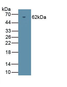 Western Blot: cGK2/PRKG2 Antibody [NBP3-41313] - Recombinant Human cGK2/PRKG2