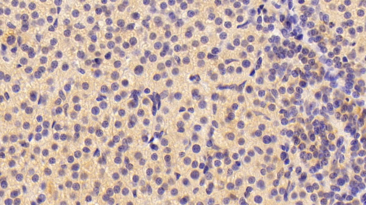 Immunohistochemistry-Paraffin: Neuritin Antibody [NBP3-41314] - DAB staining on IHC-P; Samples: Porcine Adrenal gland Tissue; Primary Ab: 10ug/ml NBP3-41314; Second Ab: 2ug/mL HRP-Linked Caprine Anti-Rabbit IgG Polyclonal Antibody