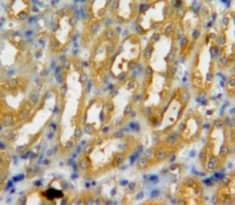 Immunohistochemistry-Paraffin: PAD3 Antibody [NBP3-41315] - Used in DAB staining on fromalin fixed paraffin-embedded kidney tissue