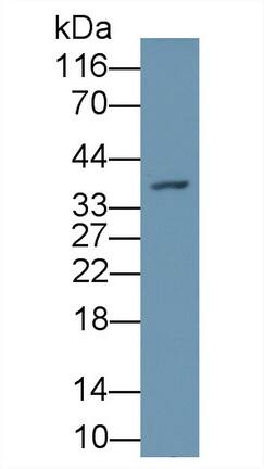 Western Blot: PAD3 Antibody [NBP3-41315] - Sample: Recombinant PAD3, Human.