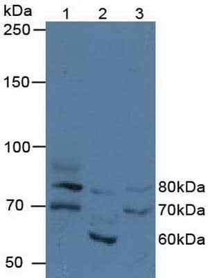 Western Blot: FIGN Antibody [NBP3-41318] - Sample: Lane1: Hela cell lysate; Lane2: Porcine Kidney lysate; Lane3: 293T cell lysate Primary Ab: 3ug/ml NBP3-41318; Second Ab: 0.2ug/mL HRP-Linked Caprine Anti-Rabbit IgG Polyclonal Antibody