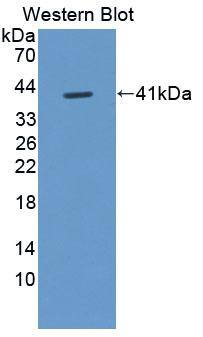 Western Blot: FIGN Antibody [NBP3-41318] - Sample: Recombinant FIGN, Human.