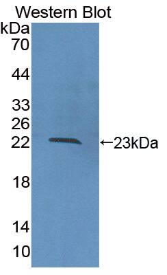 Western Blot COL16A1 Antibody