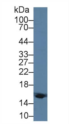 Western Blot Hemoglobin delta Antibody