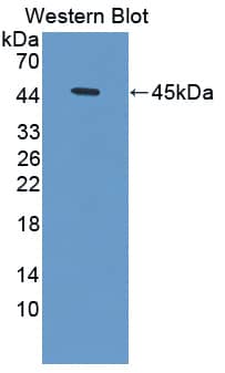 Western Blot Hemoglobin delta Antibody