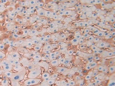 Immunohistochemistry-Paraffin Hemoglobin delta Antibody