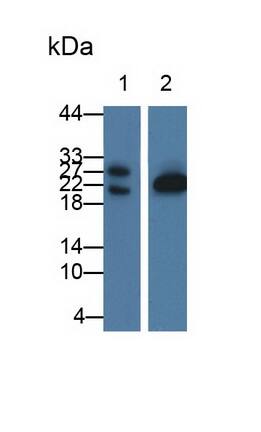 Western Blot: GLTP Antibody [NBP3-41322] - Sample: Lane1: Porcine Stomach lysate; Lane2: Mouse Cerebrum lysate Primary Ab: 1ug/ml NBP3-41322; Second Ab: 0.2ug/mL HRP-Linked Caprine Anti-Rabbit IgG Polyclonal Antibody