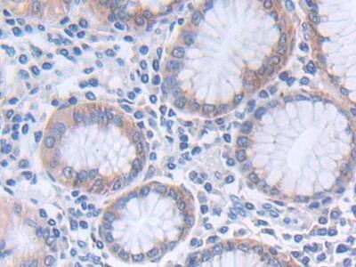 Immunohistochemistry-Paraffin: GLTP Antibody [NBP3-41322] - DAB staining on IHC-P; Samples: Human Stomach Tissue; Primary Ab: 30ug/ml NBP3-41322; Second Ab: 2ug/mL HRP-Linked Caprine Anti-Rabbit IgG Polyclonal Antibody