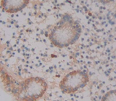 Immunohistochemistry-Paraffin: ABCA12 Antibody [NBP3-41324] - Used in DAB staining on fromalin fixed paraffin- embedded Kidney tissue