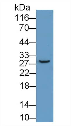 Western Blot: ABCA12 Antibody [NBP3-41324] - Sample: Recombinant ABCA12, Human.