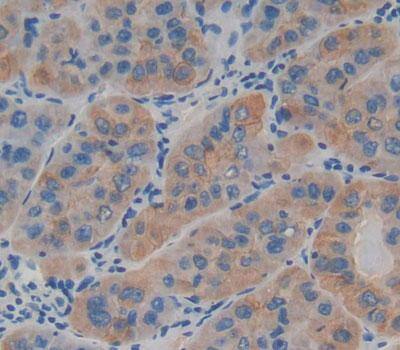 Immunohistochemistry-Paraffin: LAMB4 Antibody [NBP3-41325] - Used in DAB staining on fromalin fixed paraffin- embedded Kidney tissue