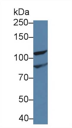 Western Blot: Inversin Antibody [NBP3-41327] - Sample: Rat Kidney lysate; Primary Ab: 1ug/ml NBP3-41327; Second Ab: 0.2ug/mL HRP-Linked Caprine Anti-Rabbit IgG Polyclonal Antibody