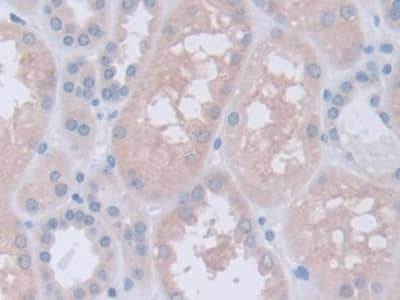 Immunohistochemistry-Paraffin: Inversin Antibody [NBP3-41327] - DAB staining on IHC-P; Samples: Human Kidney Tissue; Primary Ab: 10ug/ml NBP3-41327; Second Ab: 2ug/mL HRP-Linked Caprine Anti-Rabbit IgG Polyclonal Antibody