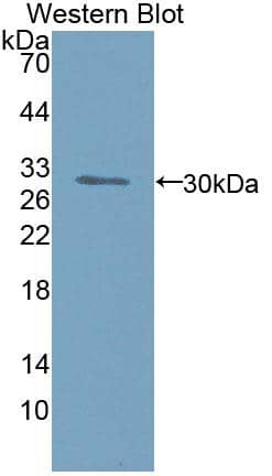 Western Blot Inversin Antibody