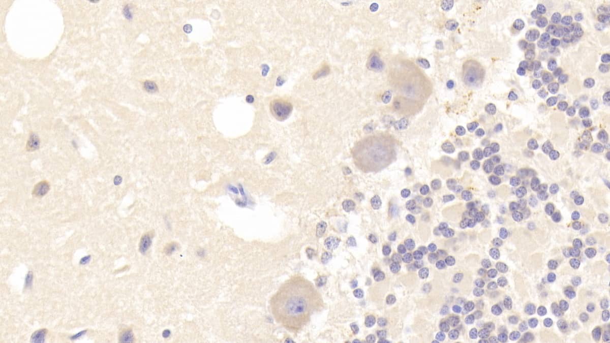 Immunohistochemistry-Paraffin: alpha Tubulin 3c Antibody [NBP3-41328] - DAB staining on IHC-P; Samples: Human Cerebellum Tissue; Primary Ab: 20ug/ml NBP3-41328; Second Ab: 2ug/mL HRP-Linked Caprine Anti-Rabbit IgG Polyclonal Antibody