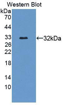 Western Blot: CROP Antibody [NBP3-41332] - Sample: Recombinant protein.