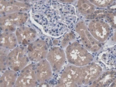 Immunohistochemistry-Paraffin: CROP Antibody [NBP3-41332] - DAB staining on IHC-P; Samples: Human Kidney Tissue; Primary Ab: 20ug/ml NBP3-41332