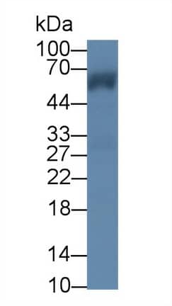 Western Blot: CROP Antibody [NBP3-41332] - Sample: Mouse Cerebrum lysate; Primary Ab: 1ug/ml NBP3-41332; Second Ab: 0.2ug/mL HRP-Linked Caprine Anti-Rabbit IgG Polyclonal Antibody