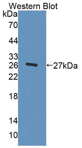 Western Blot: Trophinin Antibody [NBP3-41333] - Sample: Recombinant Trophinin, Human.