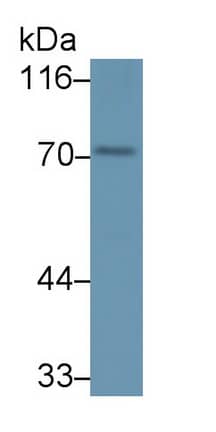 Western Blot: PADI1 Antibody [NBP3-41334] - Sample: Mouse Testis lysate Primary Ab: 1ug/ml NBP3-41334; Second Ab: 0.2ug/mL HRP-Linked Caprine Anti-Rabbit IgG Polyclonal Antibody