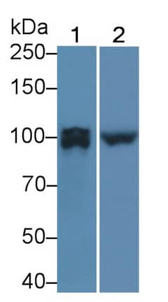 Western Blot PTP pi/PTPRU Antibody