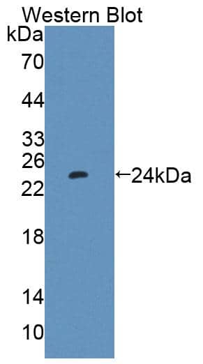 Western Blot PTP4A1 Antibody