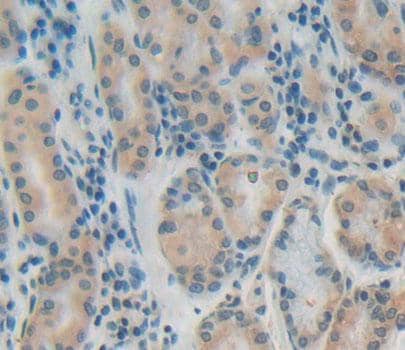 Immunohistochemistry-Paraffin PTP4A1 Antibody