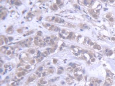 Immunohistochemistry-Paraffin ABCB6 Antibody