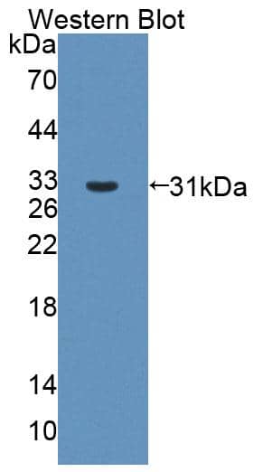 Western Blot ABCB6 Antibody