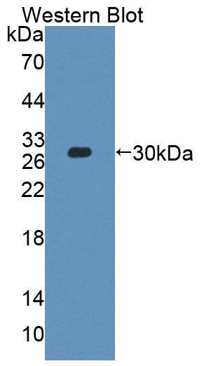 Western Blot: PLCH2 Antibody [NBP3-41340] - Sample: Recombinant protein.