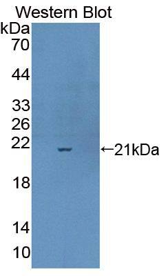 Western Blot Complexin-1 Antibody