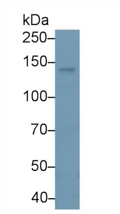 Western Blot: PLC-beta 4 Antibody [NBP3-41343] - Sample: Human 293T cell lysate; Primary Ab: 2ug/ml NBP3-41343; Second Ab: 0.2ug/mL HRP-Linked Caprine Anti-Rabbit IgG Polyclonal Antibody