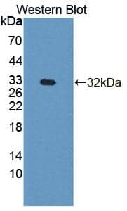 Western Blot: PLC-beta 4 Antibody [NBP3-41343] - Sample: Recombinant protein.