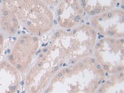 Immunohistochemistry-Paraffin: Persephin Antibody [NBP3-41351] - DAB staining on IHC-P; Samples: Human Kidney Tissue; Primary Ab: 30ug/ml NBP3-41351; Second Ab: 2ug/mL HRP-Linked Caprine Anti-Rabbit IgG Polyclonal Antibody