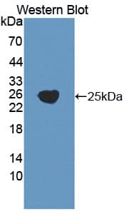 Western Blot: GGT5 Antibody [NBP3-41355] - Sample: Recombinant protein.