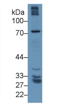 Western Blot: GGT5 Antibody [NBP3-41355] - Sample: Human Lung lysate; Primary Ab: 1ug/ml NBP3-41355; Second Ab: 0.2ug/mL HRP-Linked Caprine Anti-Rabbit IgG Polyclonal Antibody