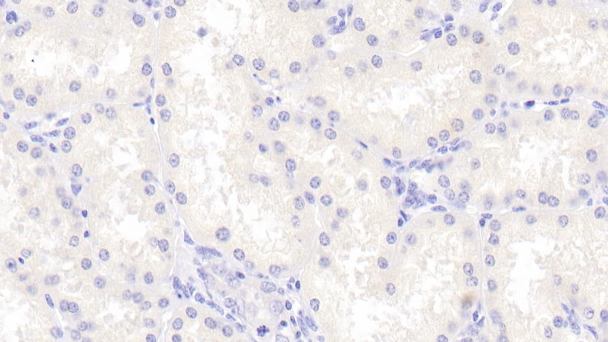 Immunohistochemistry-Paraffin Cerebellin-1/Precerebellin Antibody - BSA Free