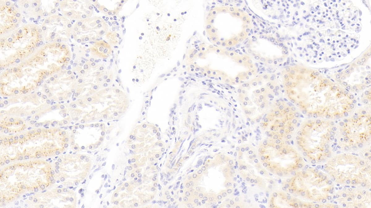 Immunohistochemistry-Paraffin IFN-alpha F/IFNA21 Antibody