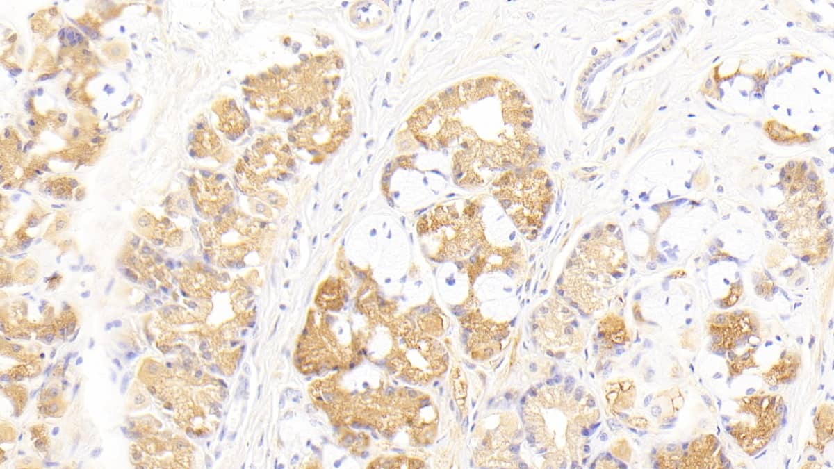 Immunohistochemistry-Paraffin IFN-alpha F/IFNA21 Antibody