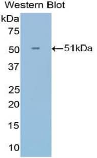 Western Blot IFN-alpha F/IFNA21 Antibody