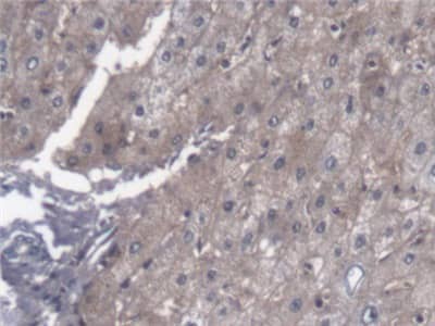 Immunohistochemistry-Paraffin: PTTG1IP Antibody [NBP3-41360] - DAB staining on IHC-P; Samples: Human Liver Tissue; Primary Ab: 20ug/ml NBP3-41360